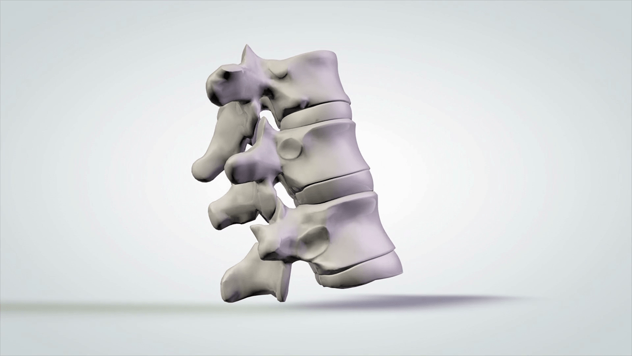 mugurkaula traumas dzemdes kakla osteohondrozes gadījumā